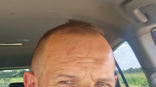 [VIDEO] Rutkowski na tropie byłych policjantów. Dariusz  Albrychowicz twierdzi, że został brutalnie pobity 